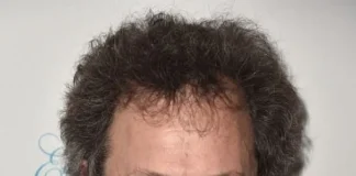 Curtis Armstrong