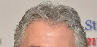 Patrick Duffy