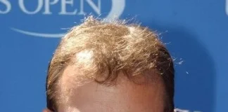 Rick Moranis